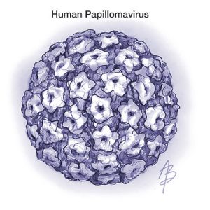 Papilloma infection